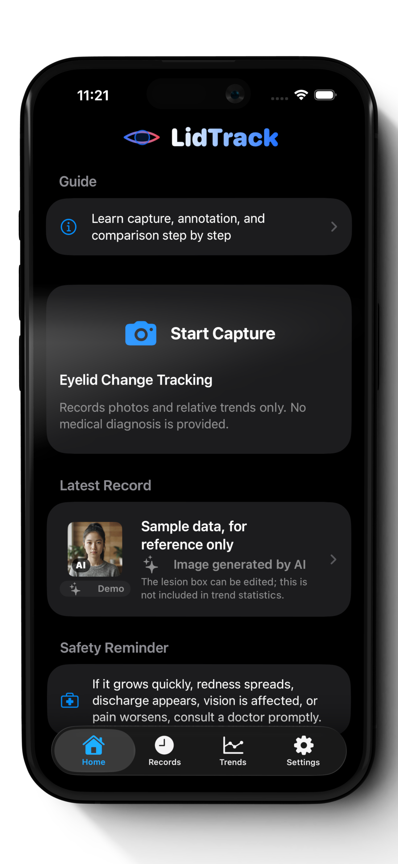 LidTrack 眼睑变化记录手机界面